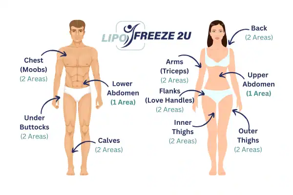 Areas you can have fat freezing treatment Chippenham
