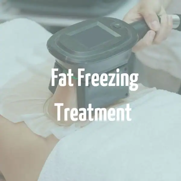 fat freezing treatment Chippenham