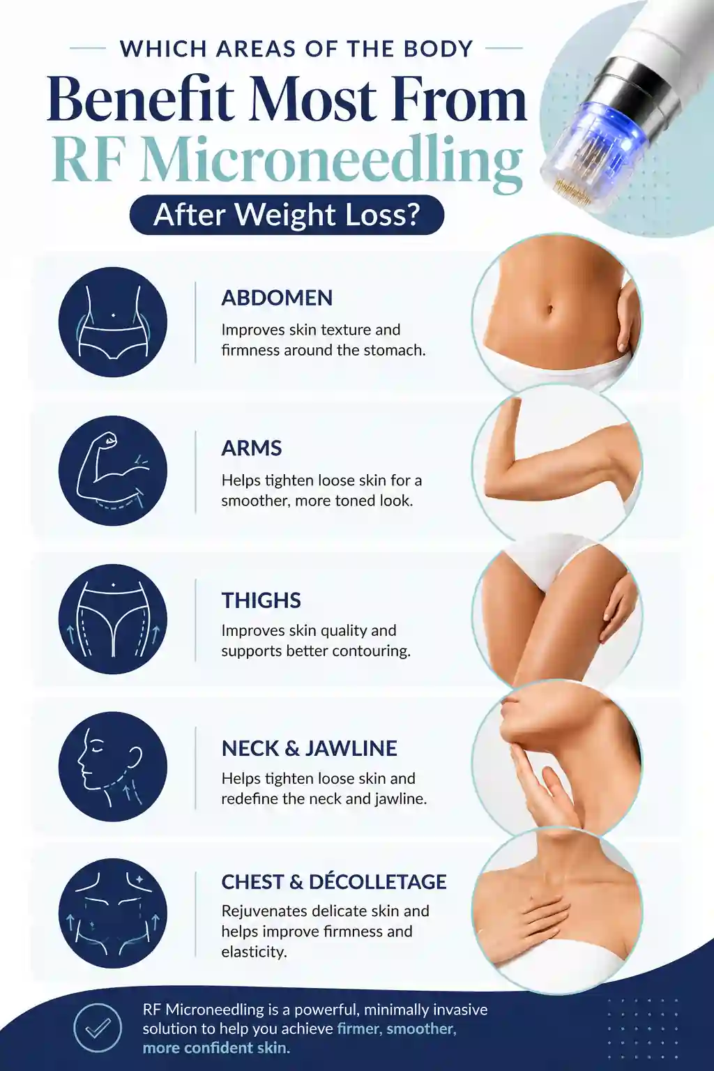Which Areas of the Body Benefit Most From RF Microneedling After Weight Loss Chippenham